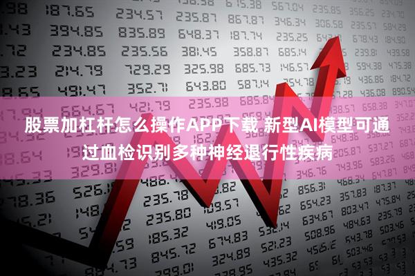 股票加杠杆怎么操作APP下载 新型AI模型可通过血检识别多种神经退行性疾病